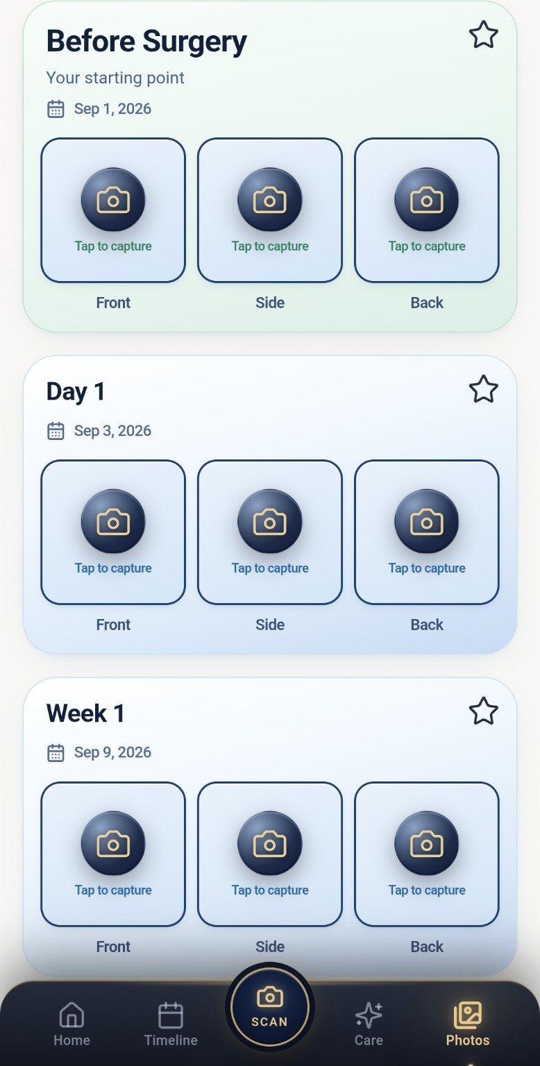 Real GraftGuide photo tracking screen showing Before Surgery, Day 1 and Week 1 photo capture
