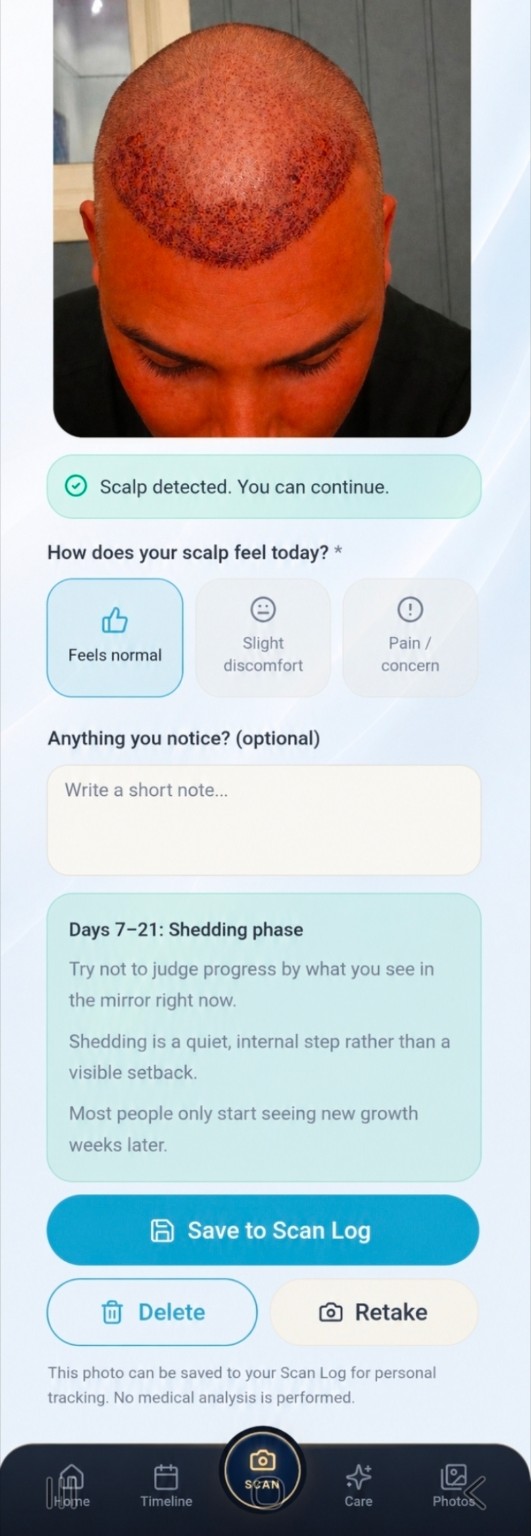 Real GraftGuide recovery check screen showing scalp detection and Scan Log controls